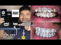 CUSTOM MOISSANITE DIAMOND GRILLZ COMPARISON IceGiant VS IceCartel