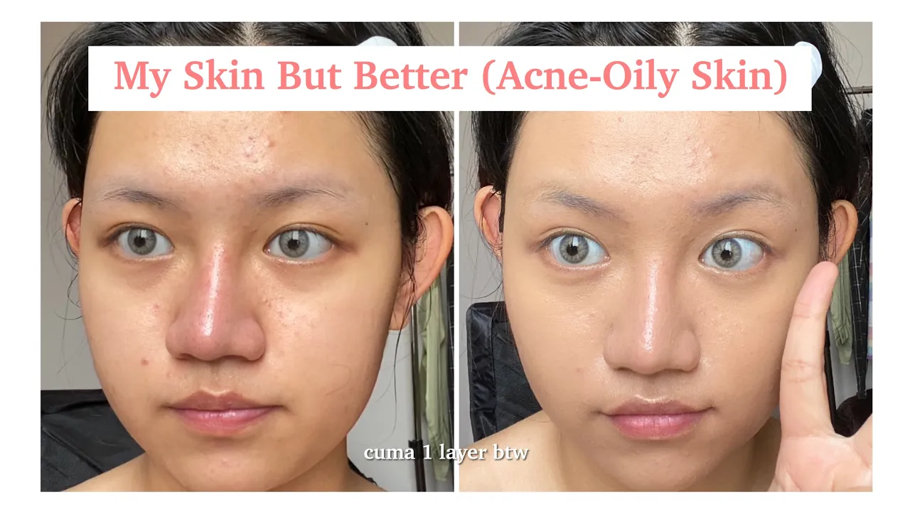 MASALAH KULIT BERMINYAK, SENSITIF, BRUNTUSAN & JERAWAT HILANG KURANG DARI SEMINGGU DENGAN CETAPHIL. 