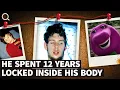 They Thought He Died 12 Years Ago Then His Eyes Moved