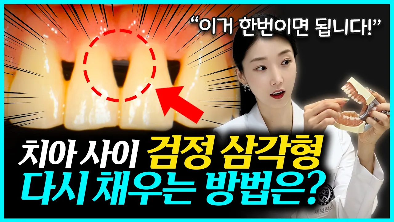 치아 사이에 생긴 틈, 5가지 원인과 치료법 전부 공개합니다!