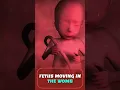 Download Lagu Fetus (BABY) Moving in the Womb