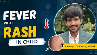 Fever with Rash in Child