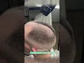 Download Lagu Thinning Hair Get Thicker, Fuller Hair in SECONDS! Hair Building Fibers Review Caboki \u0026 More