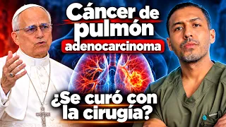 cirugia del Cancer de pulmon del papa leon XIV - ¿Se curo?