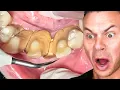 Dentist Reacts! I've NEVER Seen Teeth Like This!