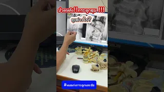  ทำไมคนสูงอายุถึงมีอาการปวดหลัง และตัวเตี้ยลงได้บ้าง 