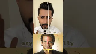 تماثل الوجه 