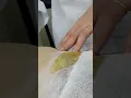 Uruguay Hair Removal Full Bikini