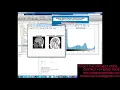 Matlab code for Medical image forgery detection for smart healthcare
