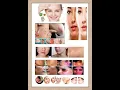 Dermovate cream