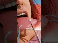 How Tongue Splitting Is Done 🤯