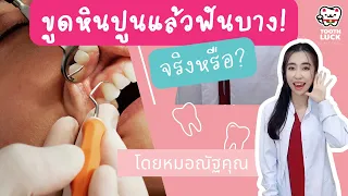  หินปูนในช่องปากเกิดจากอะไร และส่งผลต่อเหงือกอย่างไร 