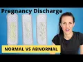 Pregnancy Discharge Vaginal Discharge During Pregnancy WHAT TO KNOW