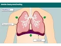 Animation showing normal breathing