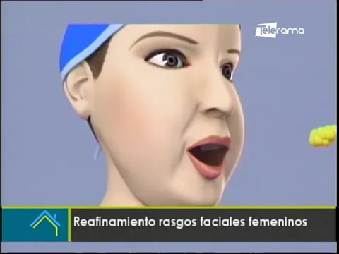 Estética al Día: Reafinamiento rasgos faciales femeninos