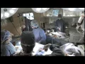Holiday Inn Express Surgeon