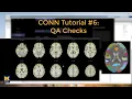 CONN Tutorial QA Checks