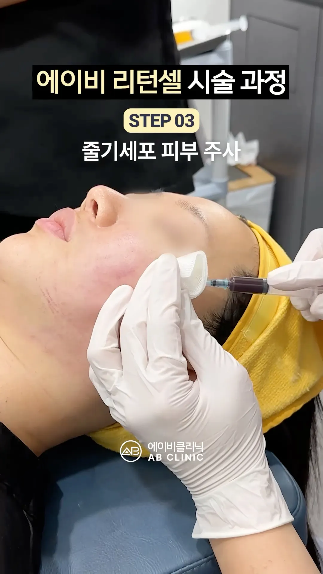 줄기세포 스킨부스터 찐 과정 👀