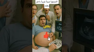 صادم الأطباء يجدون شيئا غريبا داخل بطن هذا الشاب لن تصدق ما هو 
