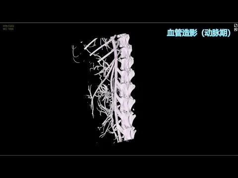 動物CT血管造影