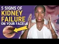 Download Lagu 5 Warning Signs Of Kidney Disease Written On Your Face! Here's What You Should Know