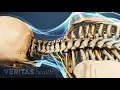 Vertebral corpectomy with Decompression CPT code - simplify medical coding