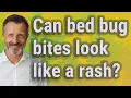 Can bed bug bites look like a rash