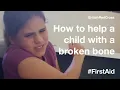 How to help a child with a broken bone