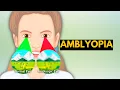 Download Lagu Amblyopia, Causes, Signs and Symptoms, Diagnosis and Treatment.