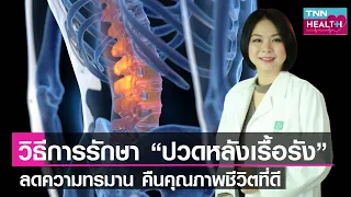 การป้องกันอาการปวดหลังเรื้อรังควรทำอย่างไร