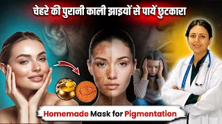 Skin की मुश्किल समस्या जैसे झाइयां, Dark Spots, Melasma से पायें छुटकारा | Upasana Ki Duniya 