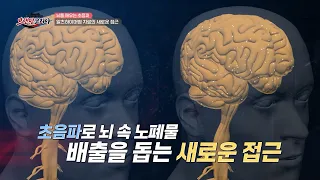 [#브랜딩코리아] 초음파로 알츠하이머병을 치료한다? 알츠하이머병 치료의 새로운 접근 | 브랜딩 코리아 16회