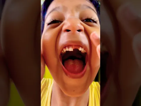 জোর করে বাবা যখন কচি দুধের দাত টান মেরে তুলে দেয় তখন আমার অবস্থা কি হয়👉#manojbin