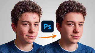 The NEW Way to Retouch Skin in Photoshop