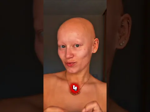 تحديت مرضي حتى أحضر زفاف صديقتي 🤍 النهاية أسعدتني #shorts