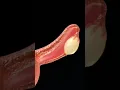 Download Lagu fallopian tube #education
