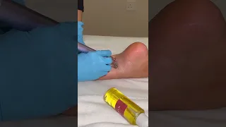 ASMR تدليك لمفاوي فائق الاسترخاء Shorts 