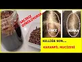 Stop baldness ! Try Clove Water If Your Hair Is Falling Out!#Natural Treatments#Homemade Cure#