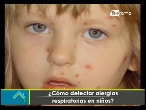 ¿Cómo detectar alergias respiratorias en niños?