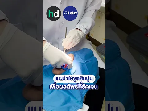 รีวิวฟอกสีฟันแบบ Zoom ที่ LDC Dental