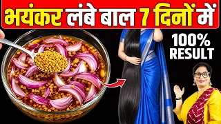 प्याज को इस तरीके से बालों में लगालो - इतने लंबे-घने हो जाएंगे कि साँभल नहीं पाओगे Hair Growth Serum