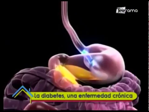 La diabetes, una enfermedad crónica
