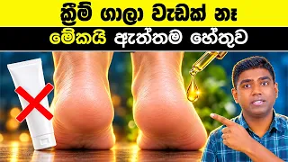 ක්‍රීම් ගෑවත් විලුඹ පැලෙන්නේ ඇයි? | The Real Reason for Cracked Heels