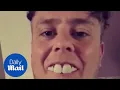 Man looks like Freddie Mercury after buying cheap veneers