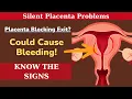 SILENT Placenta Problems 7 Warning Signs Every Pregnant Mom Must Know DrHa Healthcare