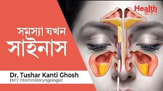  what is sinus sinus home remedy in bengali