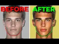 Download Lagu Avoid these 5 Mewing MISTAKES for a sharp jawline fast