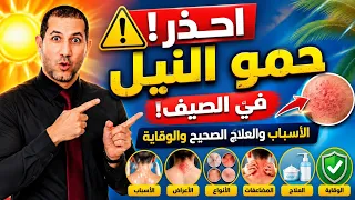  احذر حمو النيل في الصيف  الأسباب والعلاج الصحيح والوقاية                   د سامح البكري دندنها