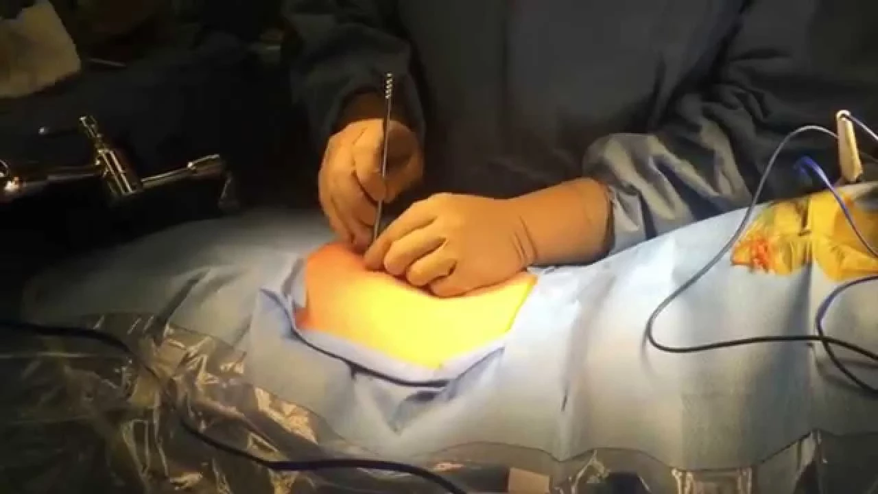 How We Treat a Herniated Disk | Physical Therapy. 
