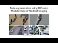 Data augmentation using Diffusion Models case of medical imaging